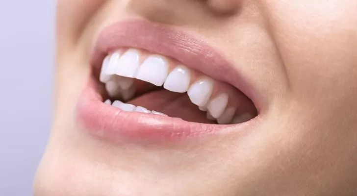 A close up of a woman's teeth